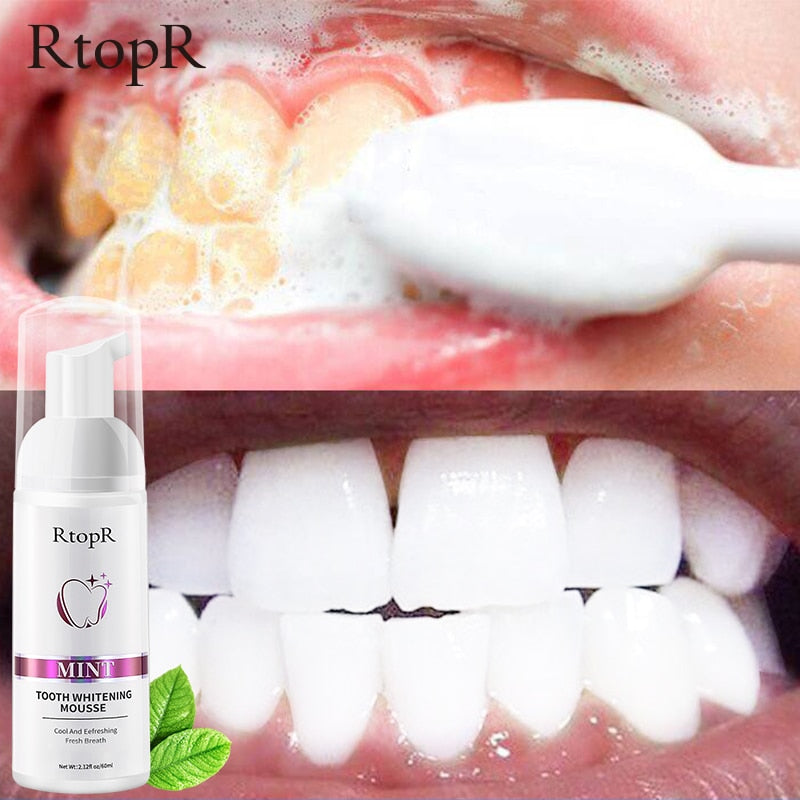Tooth Whitening Mousse – Gentle