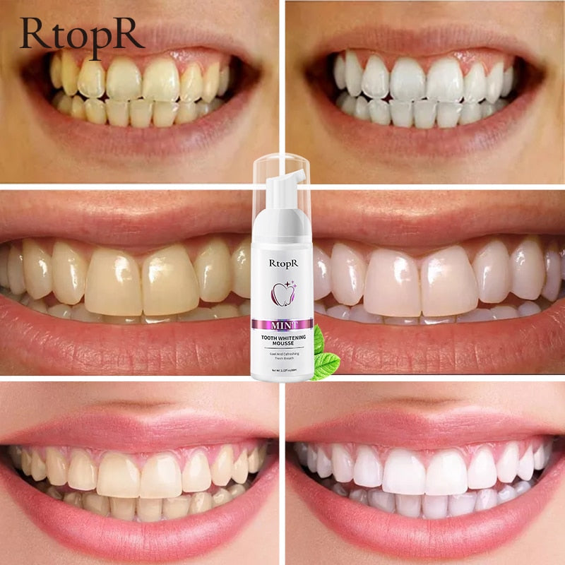 Tooth Whitening Mousse – Gentle