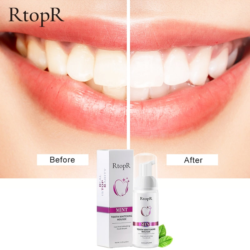 Tooth Whitening Mousse – Gentle