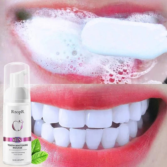 Tooth Whitening Mousse – Gentle