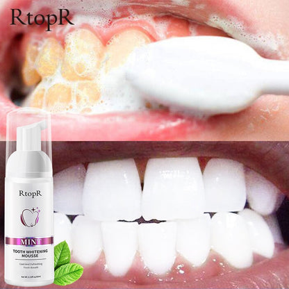 Tooth Whitening Mousse – Gentle