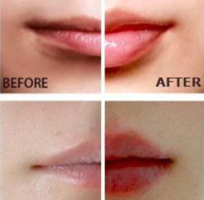 Miracle Lip Plumper for Fuller